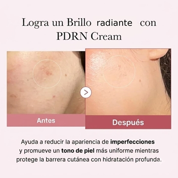 Crema Facial PDRN Pink Hyaluronic Moisturizing Cream 50ml | Medicube - Imagen 2